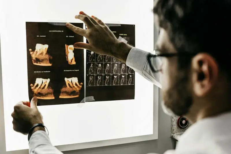 Implantología en Clínica KDENT Concepción