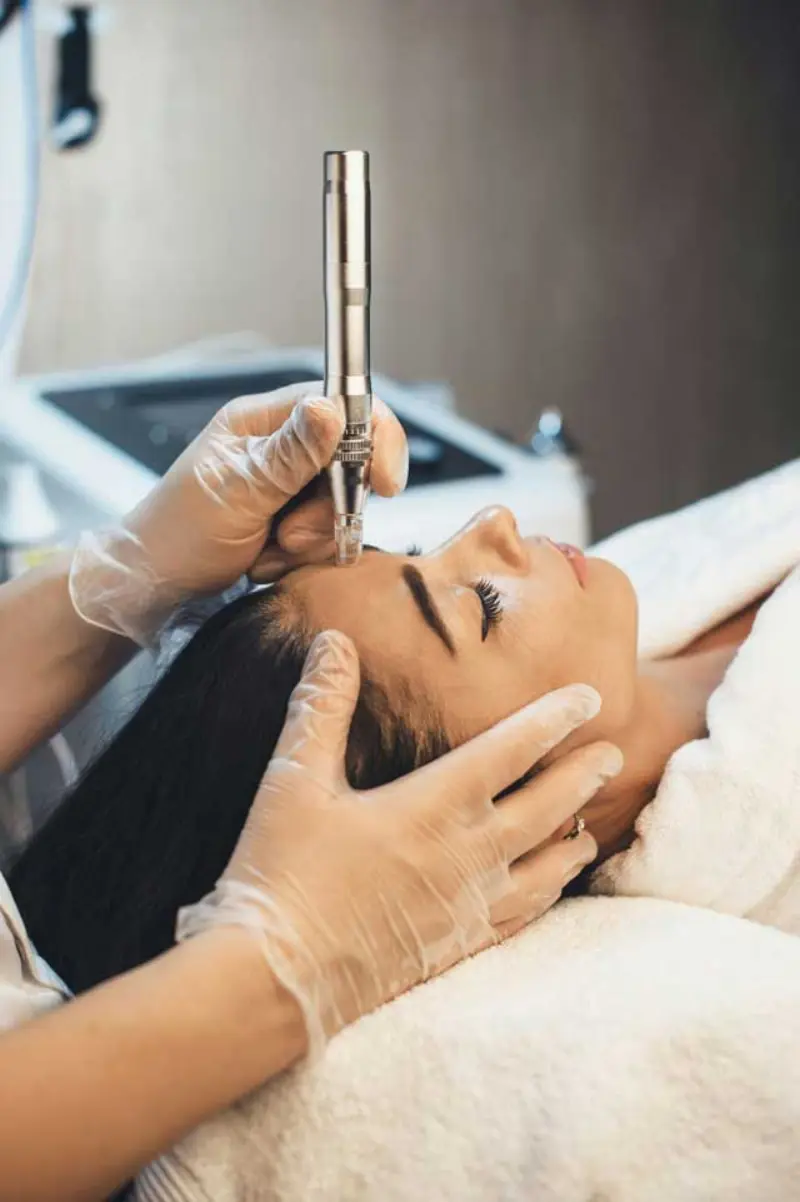 Mesoterapia con NCTF 135-HA + Higiene oral - Promoción en Clínica KDENT Concepción